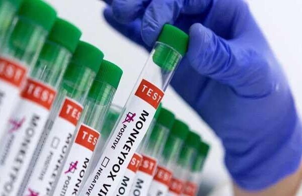 first-case-of-latest-mpox-variant-detected-in-uk:-health-authority