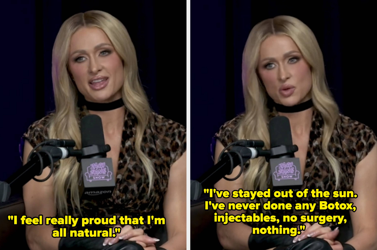 paris-hilton-said-she’s-never-done-any-“botox,-injectables”-or-any-cosmetic-surgery