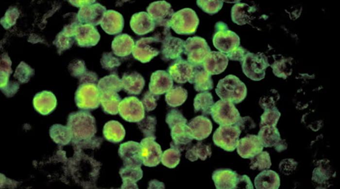 karachi-records-first-naegleria-fowleri-death-of-2025