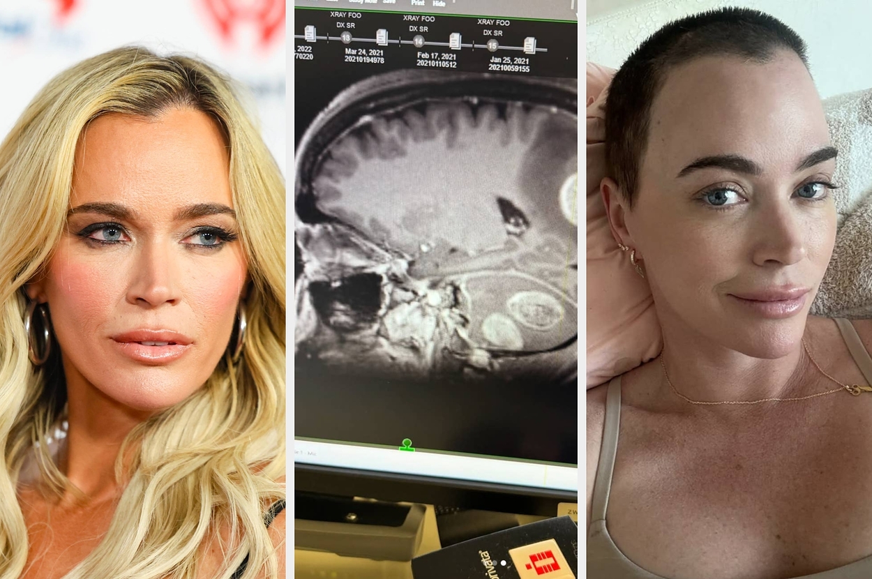 “real-housewives”-star-teddi-mellencamp-reveals-she’s-been-diagnosed-with-more-brain-tumors-and-is-still-undergoing-treatment